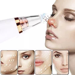 Succionador de poros facial